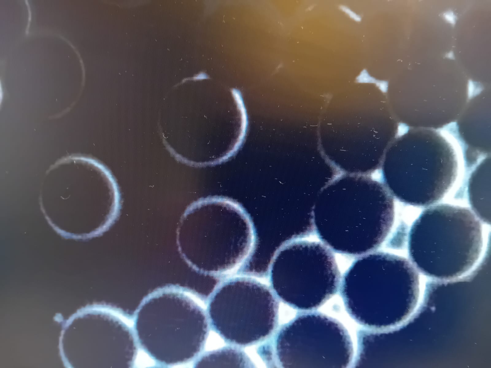 Globules rouges après prise d'eau StructWater