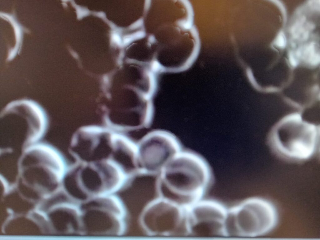GLOBULE ROUGE AVNAT UNE PRISE D'EAU STRUCTURÉE